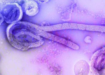 Ebola Virüsü Hastalığı