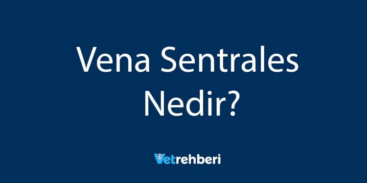 Vena Sentrales Nedir?