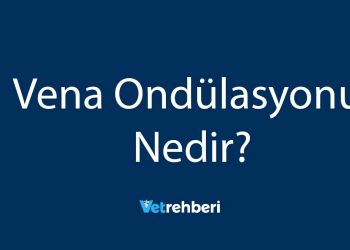 Vena Ondülasyonu Nedir?
