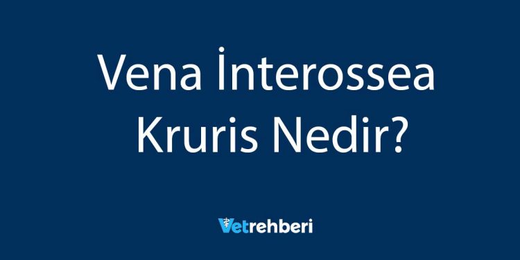 Vena İnterossea Kruris Nedir?