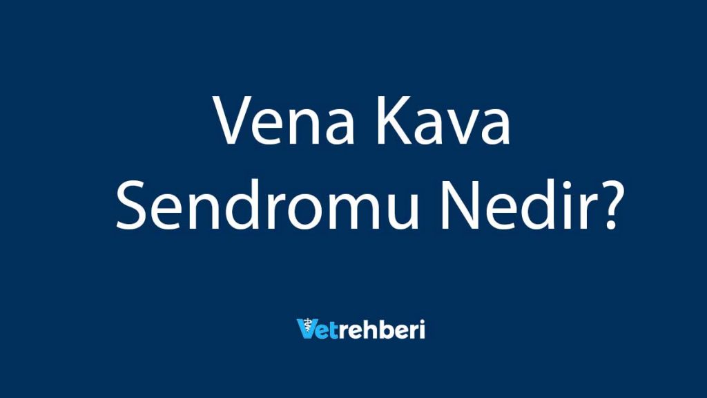 Vena Kava Sendromu Nedir?