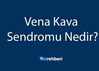 Vena Kava Sendromu Nedir?