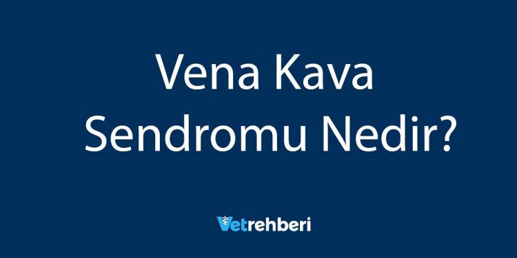 Vena Kava Sendromu Nedir?