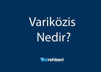 Variközis Nedir?