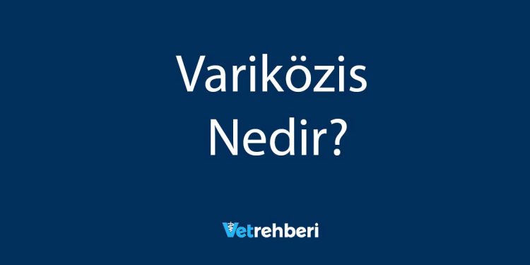 Variközis Nedir?