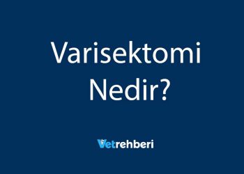 Varisektomi Nedir?