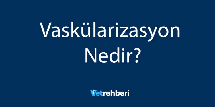 Vaskülarizasyon Nedir?