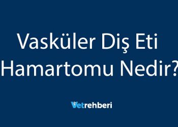 Vasküler Diş Eti Hamartomu Nedir?