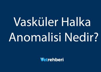 Vasküler Halka Anomalisi Nedir?