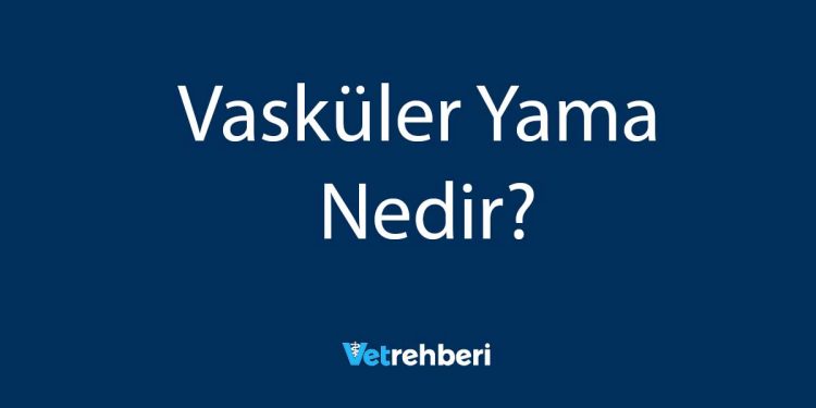 Vasküler Yama Nedir?