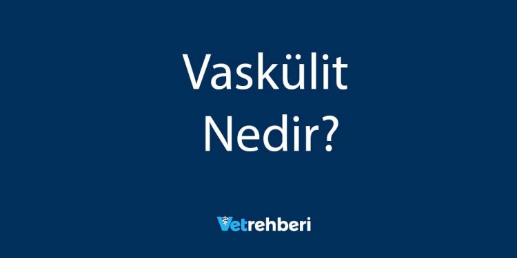 Vaskülit Nedir?