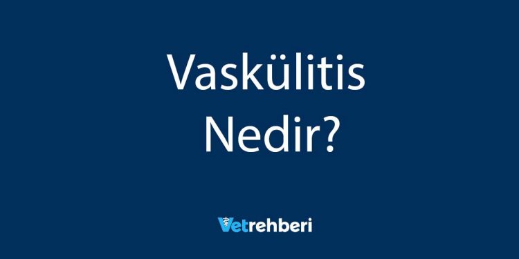 Vaskülitis Nedir?