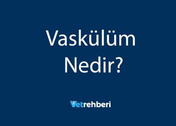 Vaskülüm Nedir?