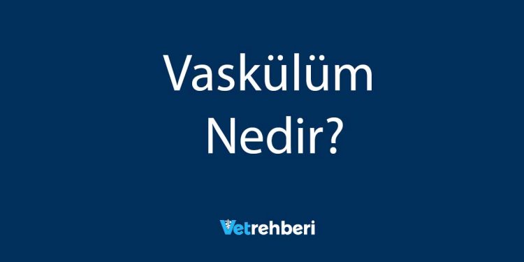 Vaskülüm Nedir?