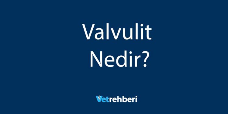 Valvulit Nedir?