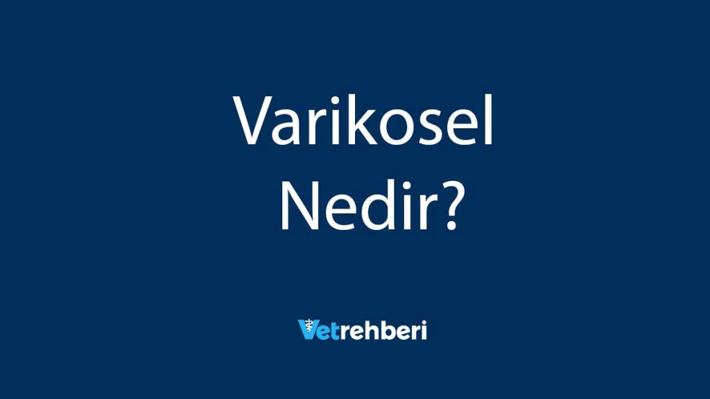 Varikosel Nedir?