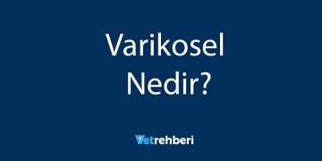 Varikosel Nedir?