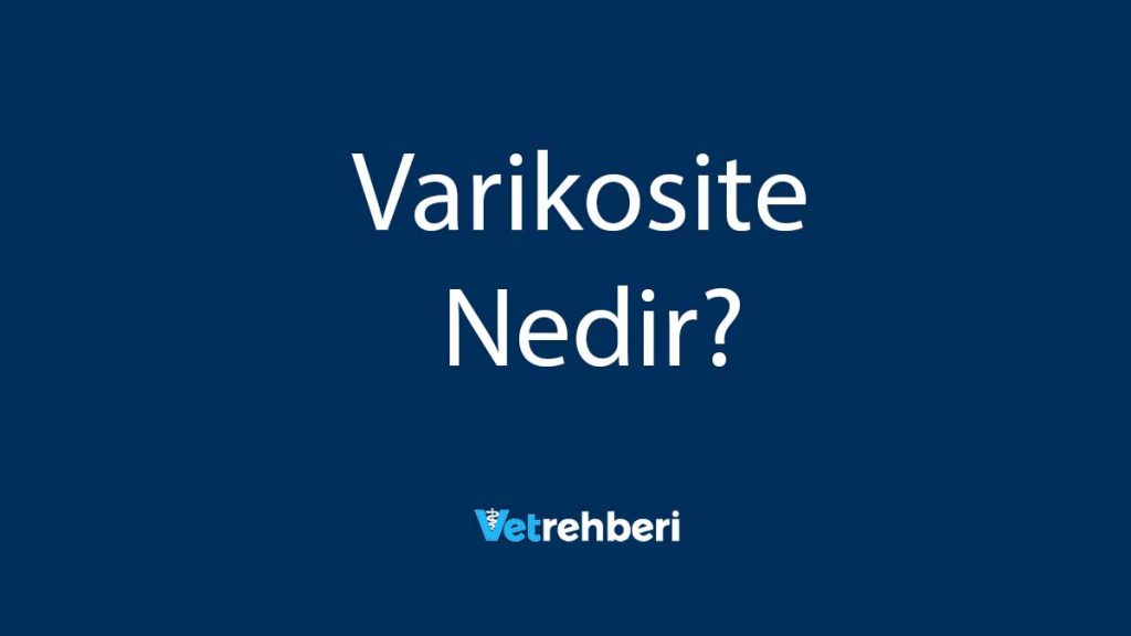 Varikosite Nedir?