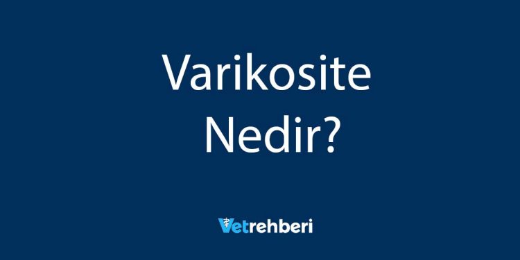 Varikosite Nedir?