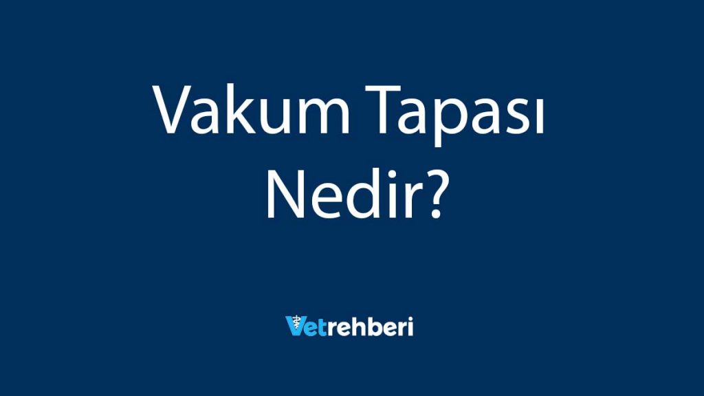 Vakum Tapası Nedir?