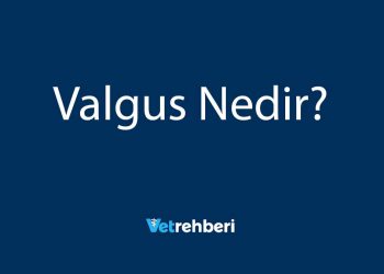 Valgus Nedir?