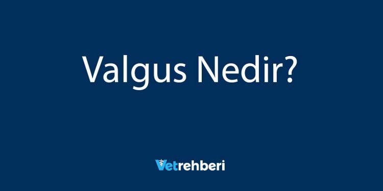 Valgus Nedir?