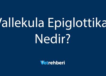 Vallekula Epiglottika Nedir?