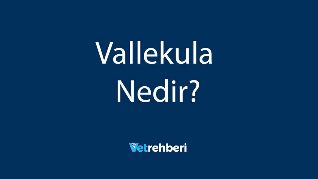 Vallekula Nedir?