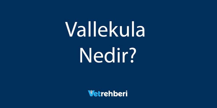 Vallekula Nedir?