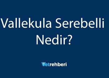 Vallekula Serebelli Nedir?