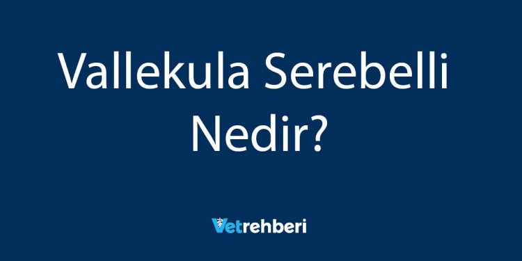 Vallekula Serebelli Nedir?