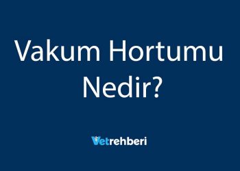 Vakum Hortumu Nedir?