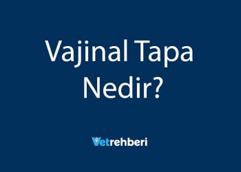 Vajinal Tapa Nedir?