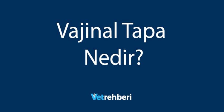 Vajinal Tapa Nedir?