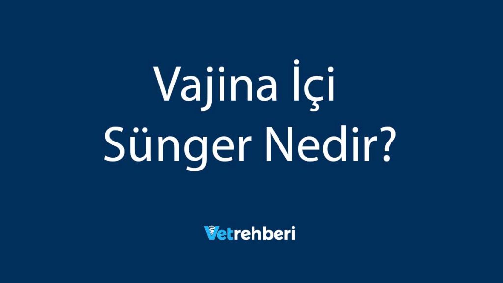 Vajina İçi Sünger Nedir?