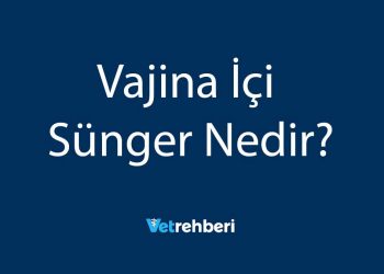 Vajina İçi Sünger Nedir?