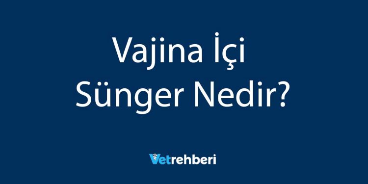 Vajina İçi Sünger Nedir?