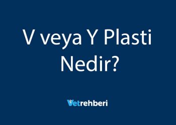 V veya Y Plasti Nedir?