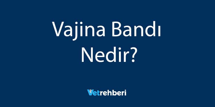 Vajina Bandı Nedir?