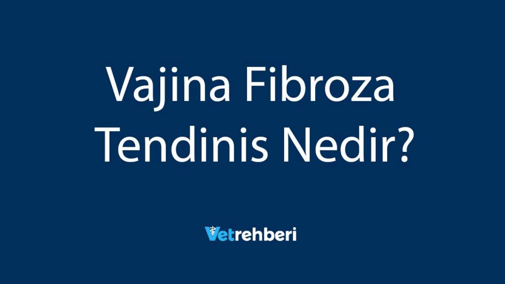 Vajina Fibroza Tendinis Nedir?