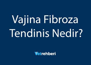 Vajina Fibroza Tendinis Nedir?