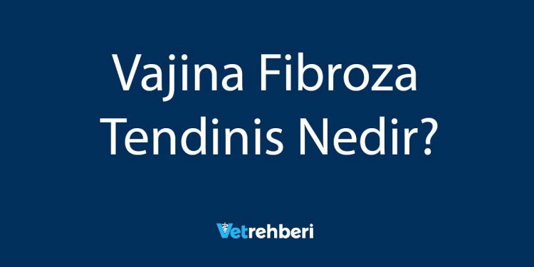 Vajina Fibroza Tendinis Nedir?