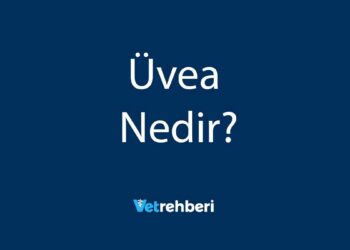Üvea Nedir?
