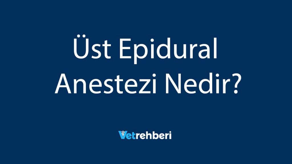 Üst Epidural Anestezi Nedir?