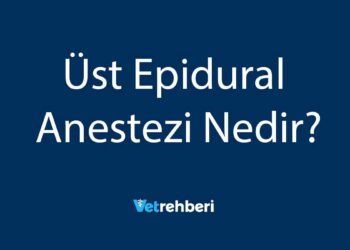 Üst Epidural Anestezi Nedir?
