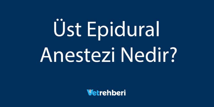 Üst Epidural Anestezi Nedir?