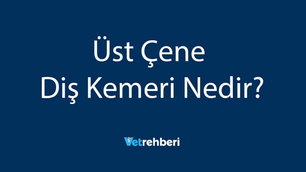 Üst Çene Diş Kemeri Nedir?