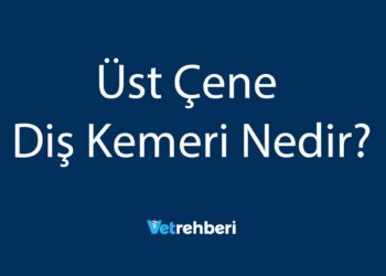 Üst Çene Diş Kemeri Nedir?