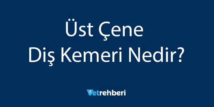 Üst Çene Diş Kemeri Nedir?