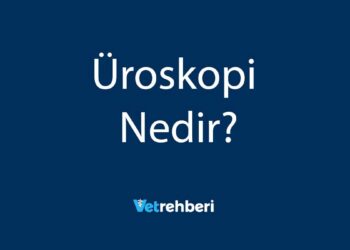 Üroskopi Nedir?